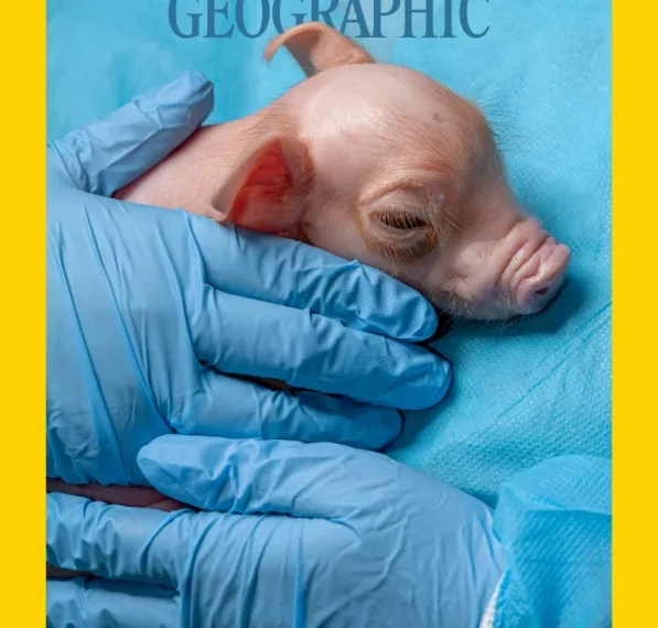 How pig kidneys could solve the organ donor crisis