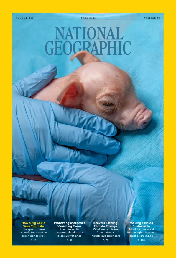 How pig kidneys could solve the organ donor crisis